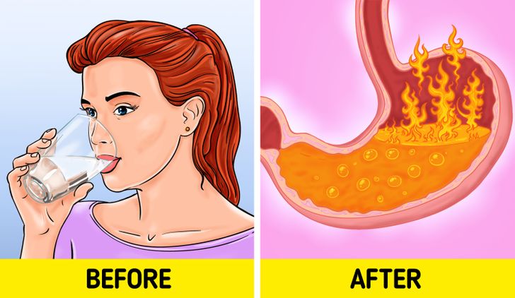 6 Ways You Might Be Making Your Acid Reflux Worse, and How to Fix It