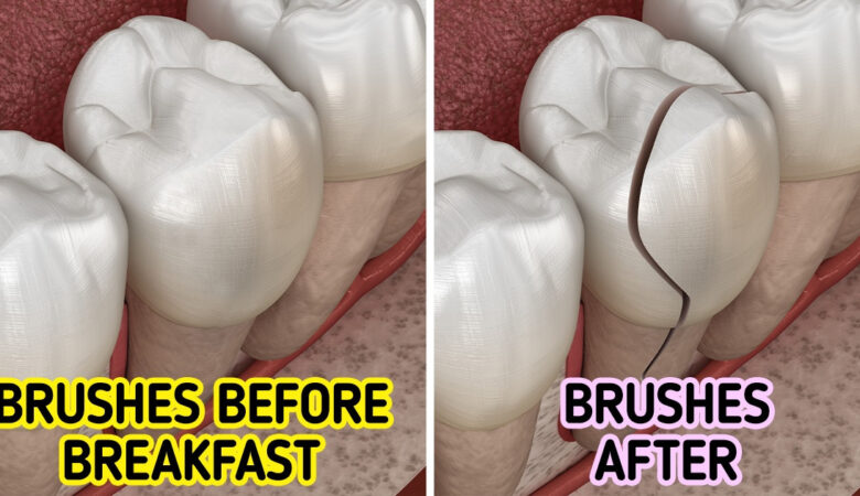 Why It’s Better Not to Brush Your Teeth After Breakfast