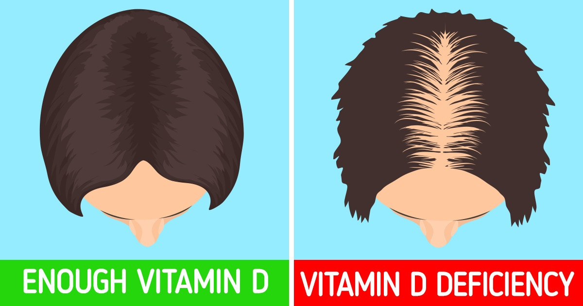 Warning Signs That You Are Lacking Vitamin D